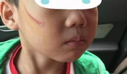 家长爆料孩子被欺负视频,孩子遭受欺凌，家长痛心疾首